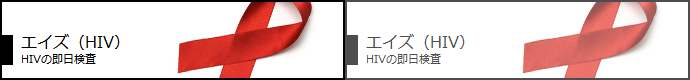エイズ（HIV）